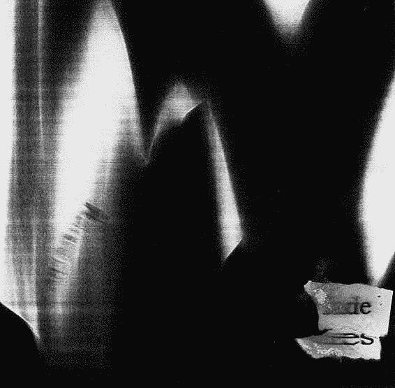 The Wood and the Trees